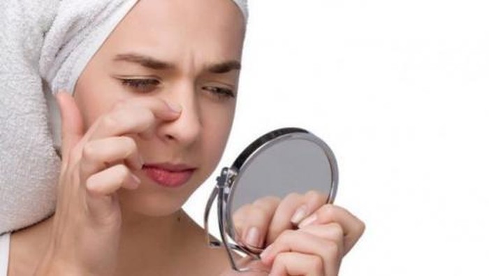 4 Langkah untuk Bantu Hilangkan Komedo