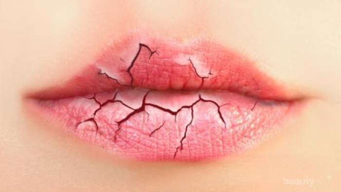 Tips Mudah Untuk Merawat Bibir Saat Puasa