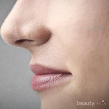 Cara Atasi Kulit Kering di Sudut Hidung