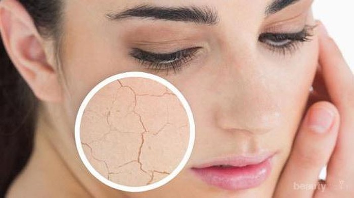 5 Kesalahan Merawat Kulit kering