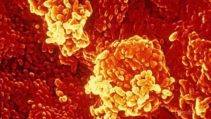 6 Masalah Kesehatan pada Miss V