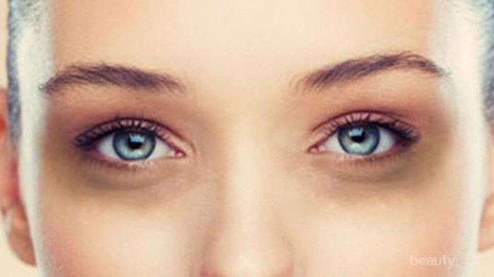 5 Cara Sederhana Mengurangi Mata Panda
