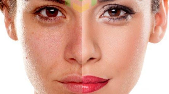 Efektif! Ini Dia 6 Tips Jitu Samarkan Flek Hitam Pada Wajah!