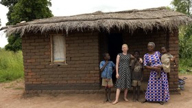 FOTO: Nasib Orang Albino di Malawi Hidup dalam Ketakutan
