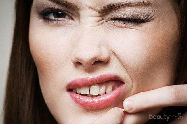 Mengenal Jenis-Jenis Jerawat pada Kulit