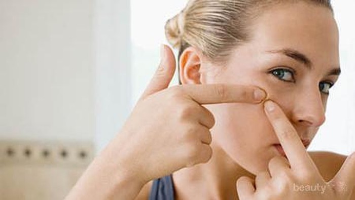 Rekomendasi Produk untuk Menghilangkan Jerawat