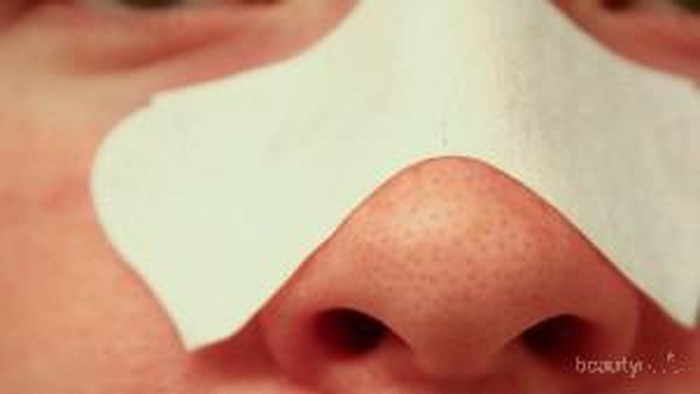 Kenali Penyebab Komedo