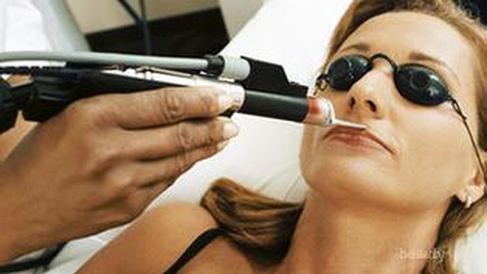 Teknik Menghilangkan Bulu dengan Laser, Amankah?