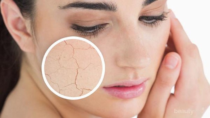 5 Faktor Luar Penyebab Kulit Kering