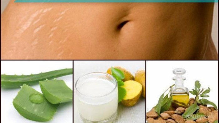 4 Bahan Alami untuk Mengatasi Stretch Mark