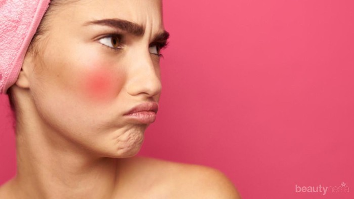 [FORUM] Gimana sih cara pilih skincare untuk kulit sensitif?