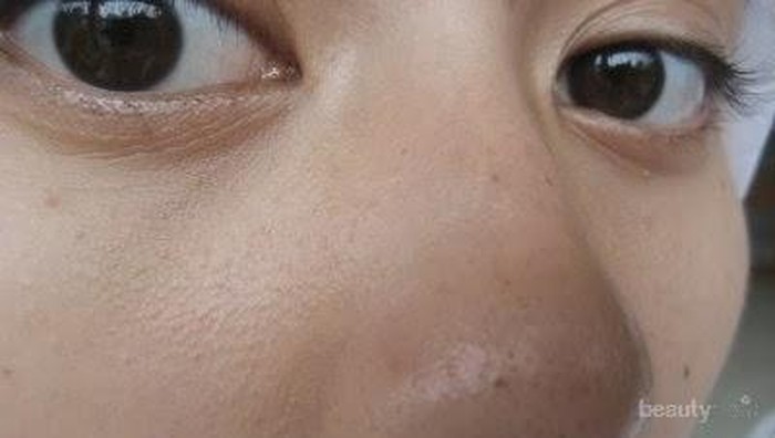 [FORUM] Olay White Radiance or Wardah?