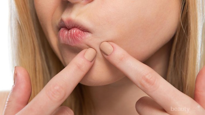 [FORUM] Nggak cuma dahi, bagian dagu aku sering banget beruntusan