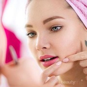 Ladies, Bahaya Enggak Sih Mencetin Komedo dan Jerawat Sendiri?
