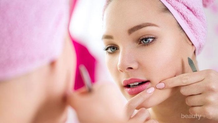 Ladies, Bahaya Enggak Sih Mencetin Komedo dan Jerawat Sendiri? Ladies, Bahaya Enggak Sih Mencetin Komedo dan Jerawat Sendiri?
