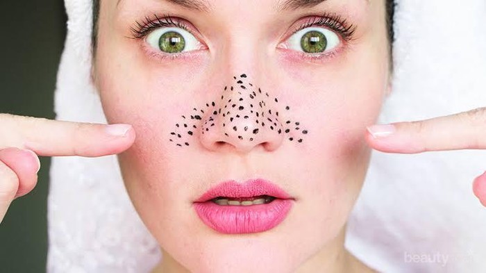 [FORUM] Bagaimana sih dear Cara Membersihkan Komedo Membandel?