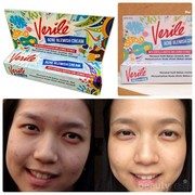 [FORUM] Ada yang pakai Verile Acne Gel? Minta reviewnya dong kak