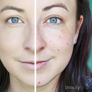 [FORUM] Minta review foundation HD liquid coverage dari Catrice dong say...