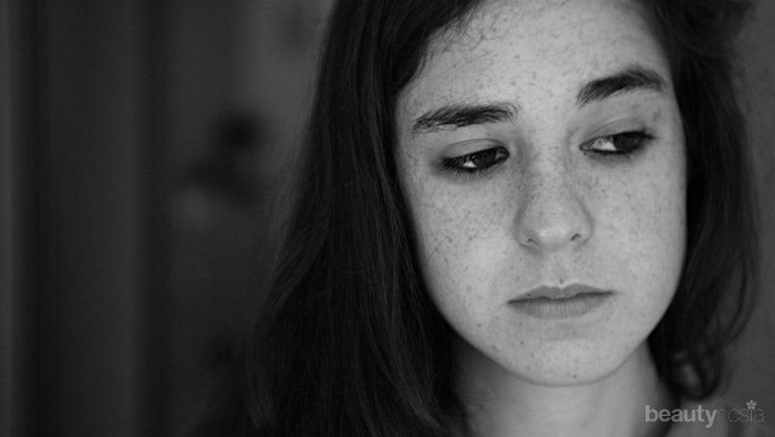 Apakah Jerawatmu Muncul Hasil Reaksi Purging atau Jerawat Biasa? Begini Cara Membedakannya!