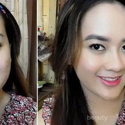 [FORUM] Sebel banget deh dear, kalau stop krim dokter pastideh jerawatan!