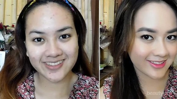 [FORUM] Sebel banget deh dear, kalau stop krim dokter pastideh jerawatan!