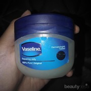 Jerawat hilang dalam 2 hari