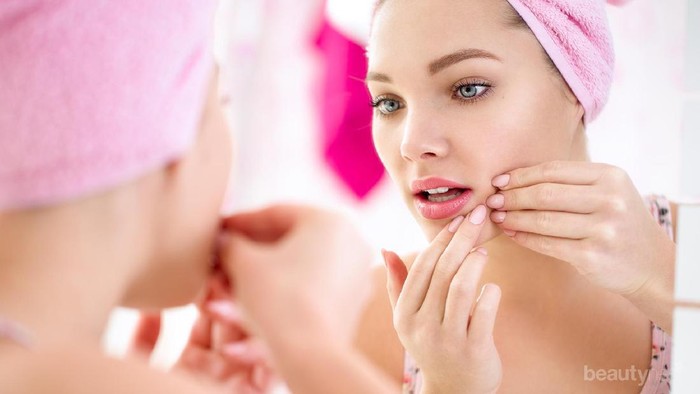 Awas, Ternyata Ini Bahaya yang Mengancam dari Hobi Memencet Komedo Sendiri!