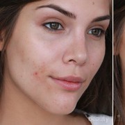 Begini Cara Mengaplikasikan Make Up dengan Hasil Flawless di Kulit Berjerawat