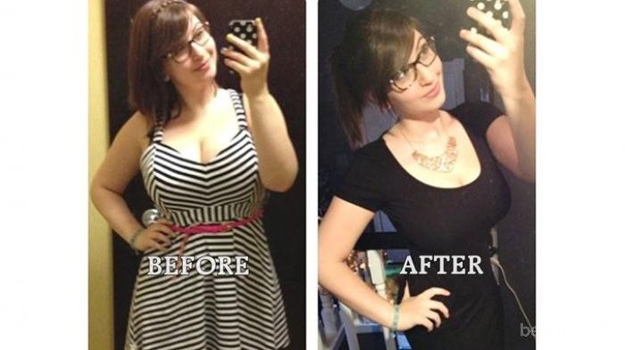 [FORUM] Temenku kurus ternyata karena minum obat...