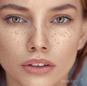 [FORUM] Freckles di wajah apakah bisa dihilangkan?