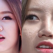 #FORUM Gak Nyangka! Ternyata Ini Cara Jitu Hilangkan Bruntusan! Ada yang Sudah Coba??