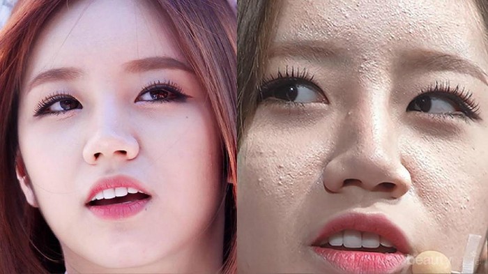 untuk masalah wajah bruntusan, yang bagus pake skincare apa ya? untuk masalah wajah bruntusan, yang bagus pake skincare apa ya?