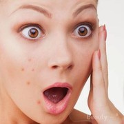 [FORUM] Apa yang biasanya langsung kamu alami ketika tidak cocok dengan produk skincare?