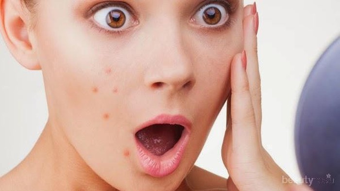 [FORUM] Apa yang biasanya langsung kamu alami ketika tidak cocok dengan produk skincare?