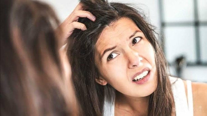 [FORUM] Ada yang Tahu Cara Menghilangkan Ketombe?