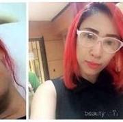 Artis ini blak-blakan mengaku operasi plastik, menurut kamu?