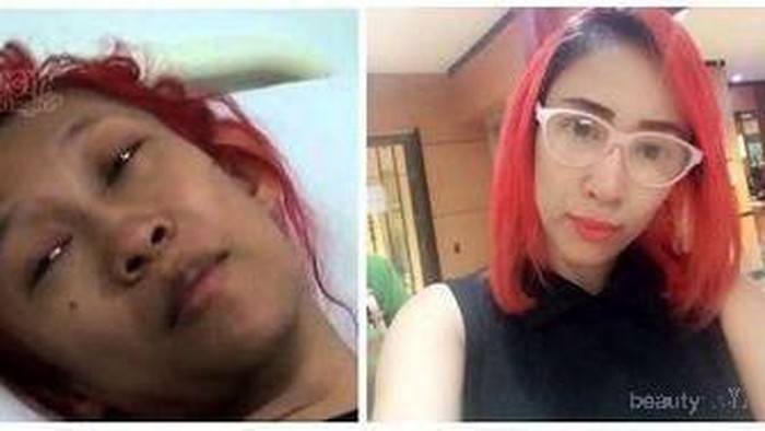 Artis ini blak-blakan mengaku operasi plastik, menurut kamu? Artis ini blak-blakan mengaku operasi plastik, menurut kamu?