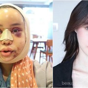 [FORUM] Seandainya boleh melakukan operasi plastik, bagian mana yang kamu rubah pertama kali?