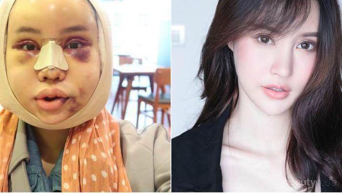 [FORUM] Seandainya boleh melakukan operasi plastik, bagian mana yang kamu rubah pertama kali?