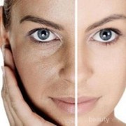 [FORUM] Mukaku tipe kulit kering dan sensitif bagusnya pake skincare apa??