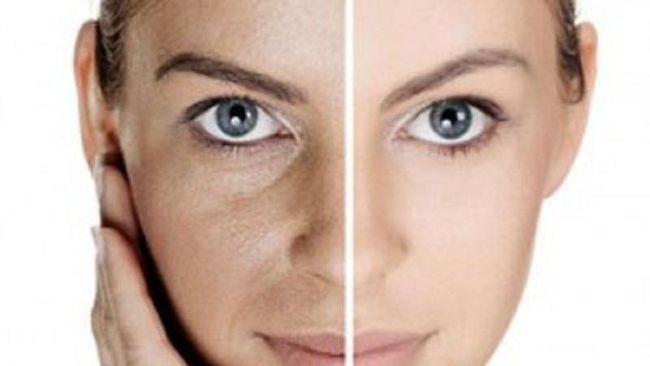 Forum Mukaku Tipe Kulit Kering Dan Sensitif Bagusnya Pake Skincare Apa