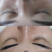 [FORUM] Serum Dermafleece katanya memanjangkan bulu mata dalam 2 minggu, sudah coba?