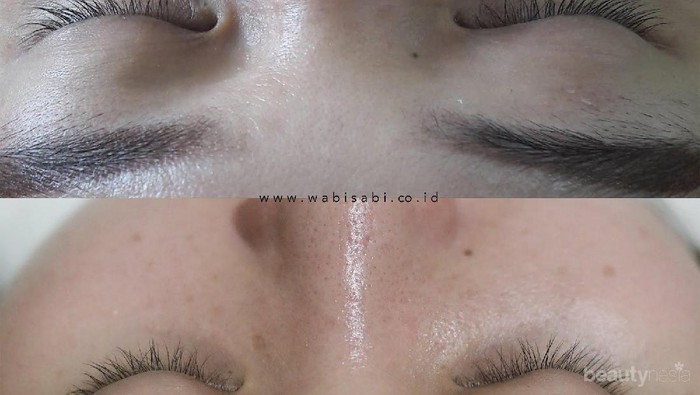 [FORUM] Serum Dermafleece katanya memanjangkan bulu mata dalam 2 minggu, sudah coba?