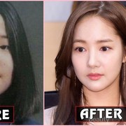 [FORUM] Mau Nggak Di-endorse Operasi Plastik Gratis?