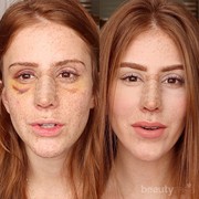 [FORUM] Viral! Selebgram ini tampilkan video transformasi setelah oplas, ih merinding!