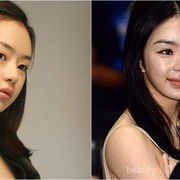 Mengerikan! Artis Korea Berikut Gagal Operasi Plastik Hingga Wajahnya Sulit Dikenali