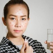 [FORUM] Girls, lebih pilih skincare dari luar atau minum vitamin kulit?