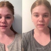 [FORUM] Benarkah cuci muka pakai air saja malah lebih bagus dibanding pakai sabun?