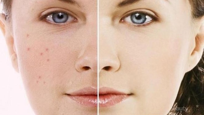 [FORUM] Pakai bedak bintik-bintik hitam muncul