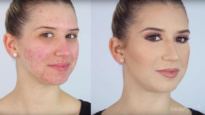 Jerawat di Wajah Tertutupi Sempurna dan Hasilnya Super Flawless Hanya dengan Cara Ini Saja